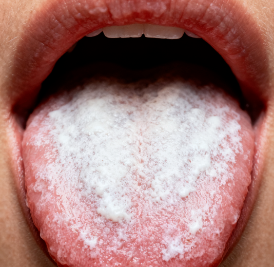 舌头出现这3种变化，暗示身体有问题！教你应对方法